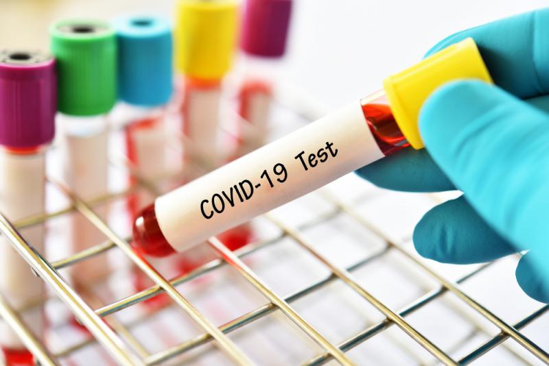 Coronavirus, 17 nuovi positivi nel weekend in Campania