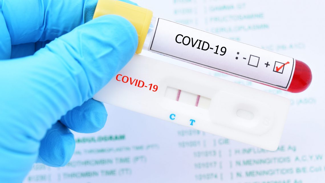 Coronavirus, bollettini contagio Campania 24-30 agosto: i numeri